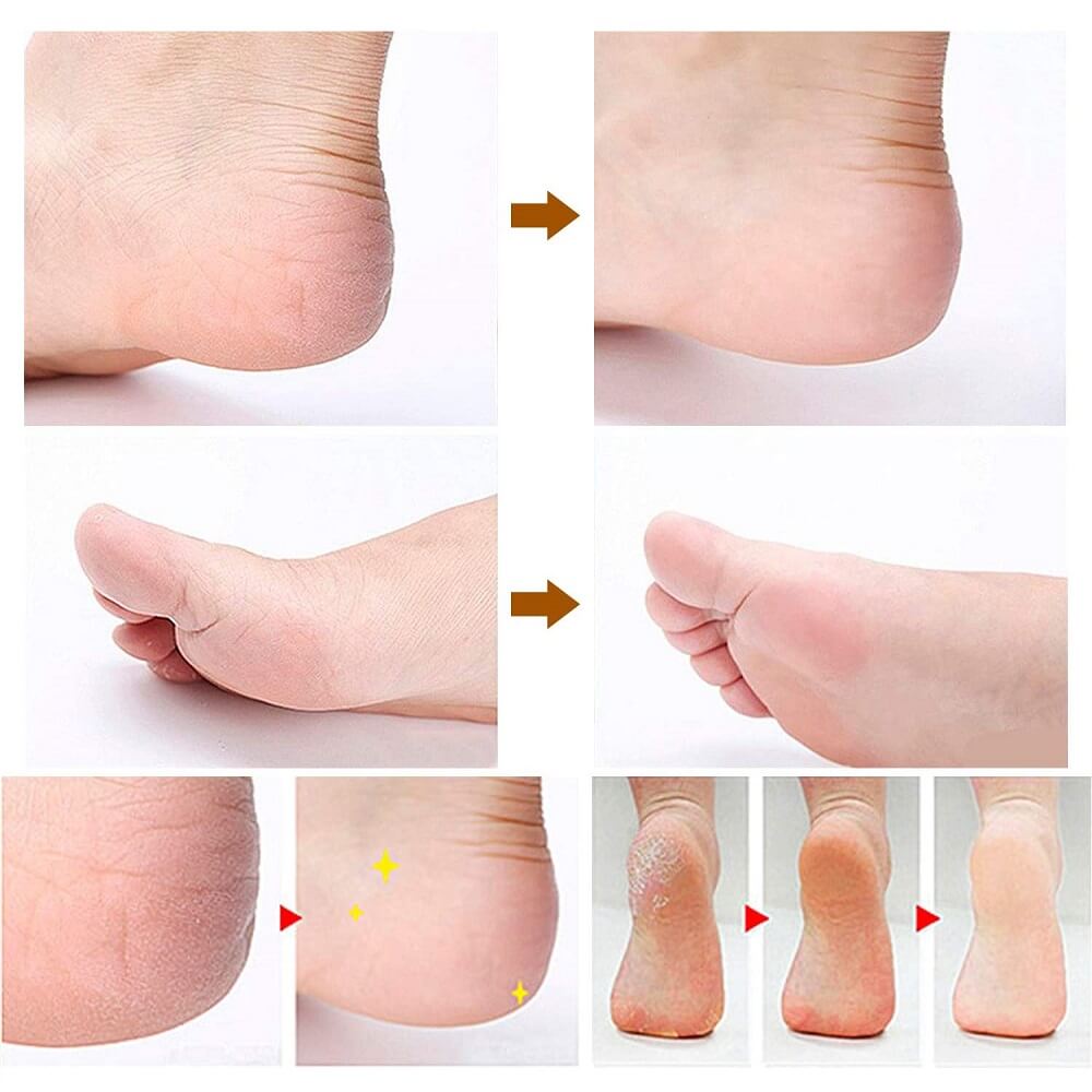 Kit de Pédicure 8 en 1 - Premium