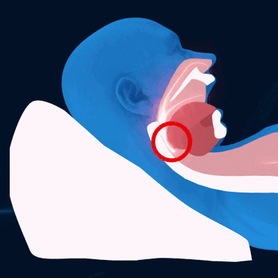 Oreiller Anti Ronflement Cervical à Memoire de Forme