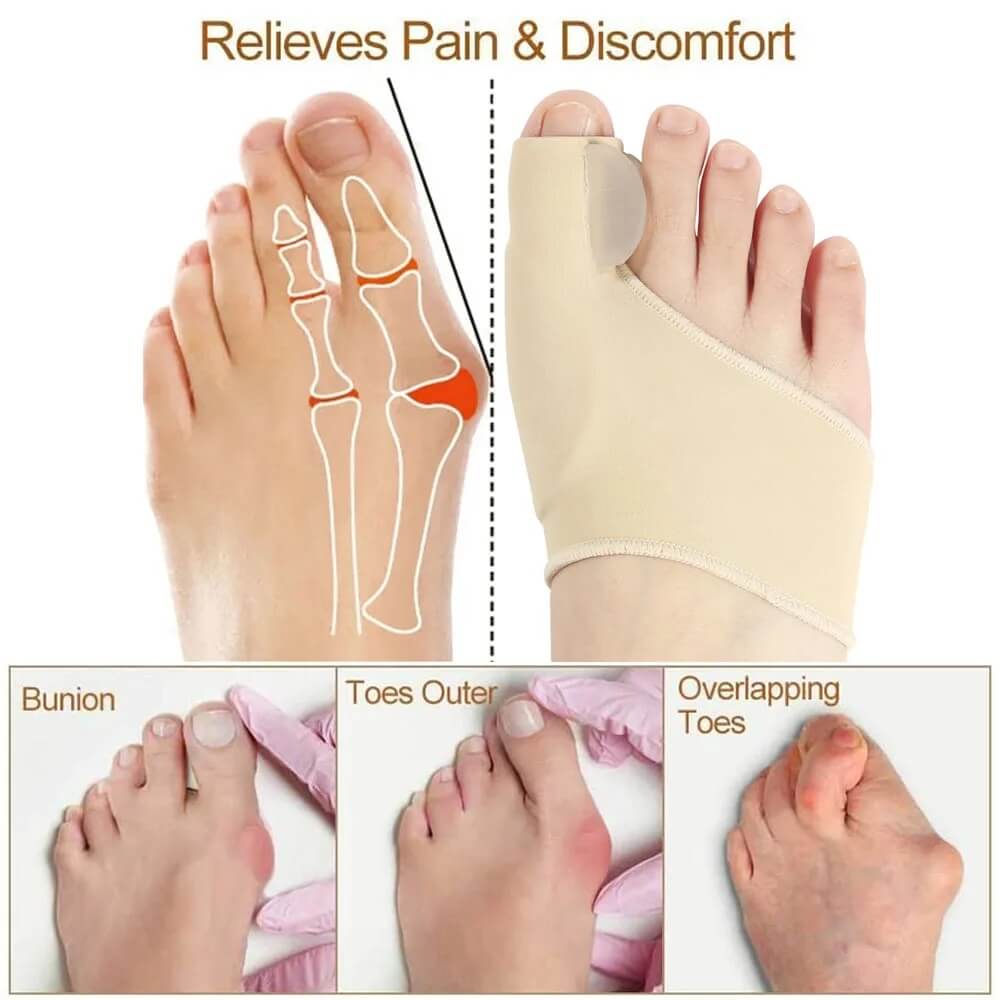 Correcteur Hallux Valgus, Orthese Orteil Separatateur